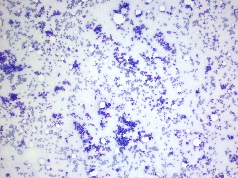 File:CytologicallyYoursUnknowns201312-5-01.jpg