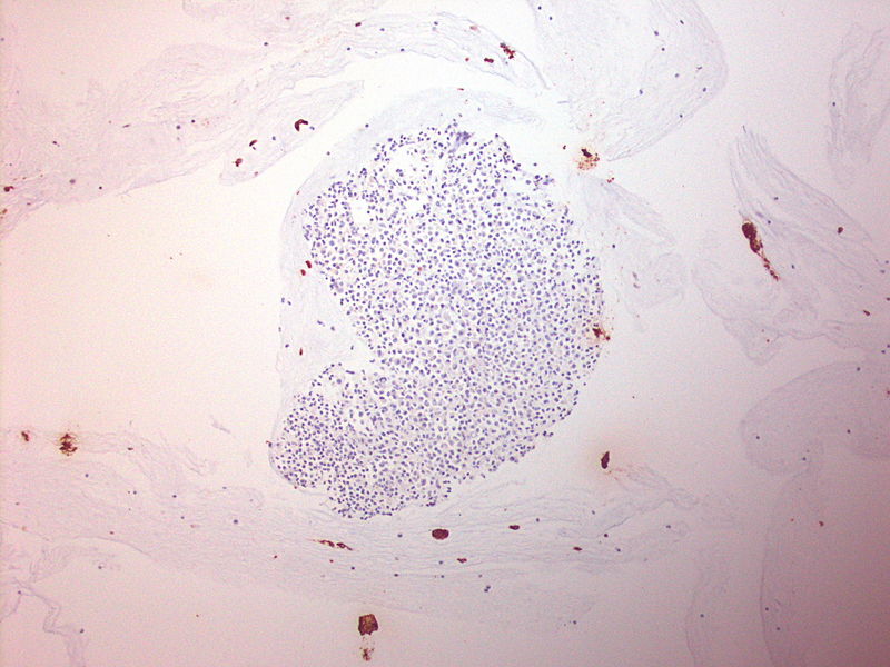 File:CytologicallyYoursUnknowns201310-3-13.jpg