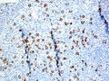 CytologicallyYoursCoW20131202Biopsy4.jpg.JPG