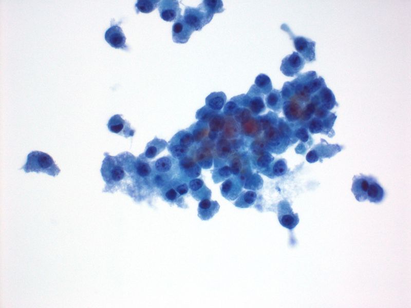 File:CytologicallyYoursUnknowns201312-1-02.jpg