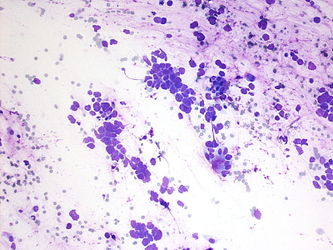 CytologicallyYoursUnknowns201310-2-03.jpg