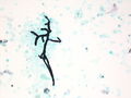 CytologicallyYoursUnknowns201310-6-07.jpg