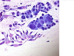 CytologicallyYoursUnknowns201310-1-08.jpg