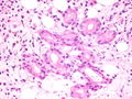 CytologicallyYoursCoW20131111Biopsy6.jpg