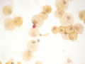 CytologicallyYoursUnknowns201310-5-09.jpg