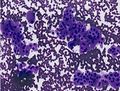 CytologicallyYoursUnknowns201311-5-03.jpg