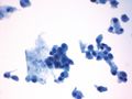 CytologicallyYoursUnknowns201312-1-03.jpg