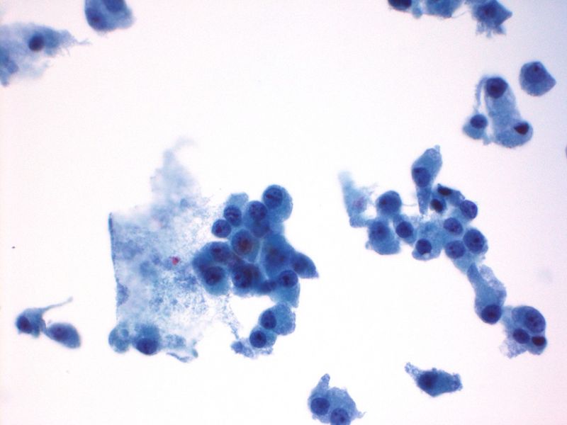 File:CytologicallyYoursUnknowns201312-1-03.jpg