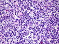 CytologicallyYoursCoW20131202Biopsy2.jpg