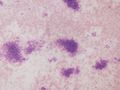 CytologicallyYoursUnknowns201311-4-01.jpg