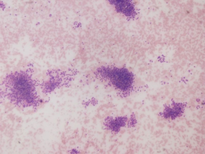 File:CytologicallyYoursUnknowns201311-4-01.jpg