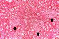 IPLab6Amyloid10.jpg