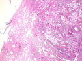 CytologicallyYoursCoW20131118Biopsy1.jpg