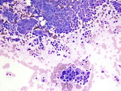 CytologicallyYoursUnknowns201310-1-05.jpg