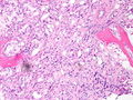 CytologicallyYoursCoW20131111Biopsy3.jpg