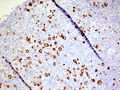 CytologicallyYoursCoW20131202Biopsy3.jpg