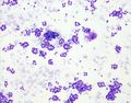 CytologicallyYoursUnknowns201311-2-02.jpg