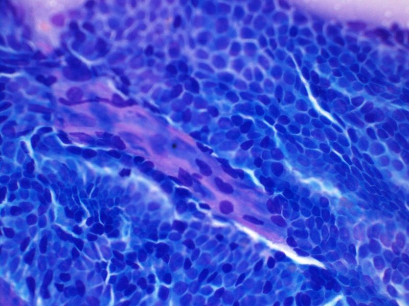 File:CytologicallyYoursUnknowns201312-2-04.jpg