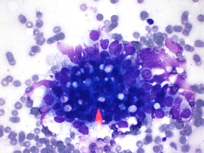 File:CytologicallyYoursUnknowns201312-4-04.jpg