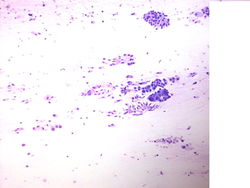 CytologicallyYoursUnknowns201310-1-07.jpg