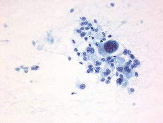 CytologicallyYoursUnknowns201401-01-06.jpg