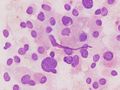 CytologicallyYoursUnknowns201311-4-03.jpg