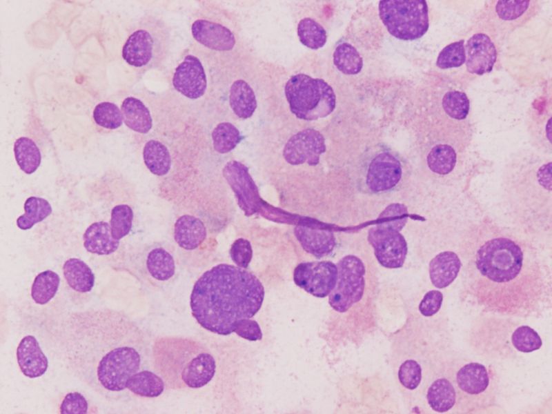 File:CytologicallyYoursUnknowns201311-4-03.jpg