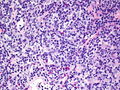 CytologicallyYoursCoW20131202Biopsy1.jpg