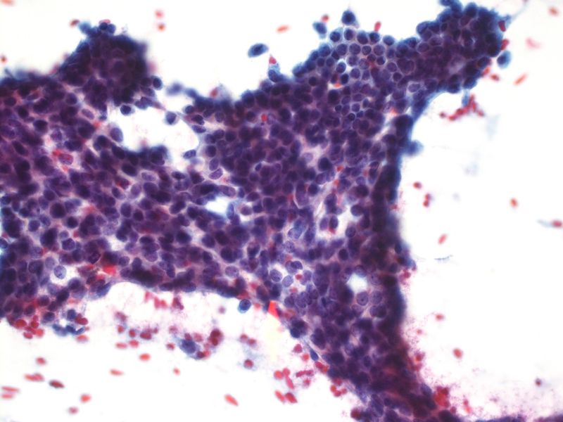 File:CytologicallyYoursUnknowns201312-3-04.jpg