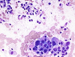 CytologicallyYoursUnknowns201310-1-06.jpg