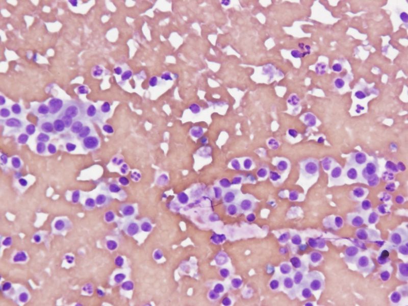 File:CytologicallyYoursUnknowns201311-5-02.jpg