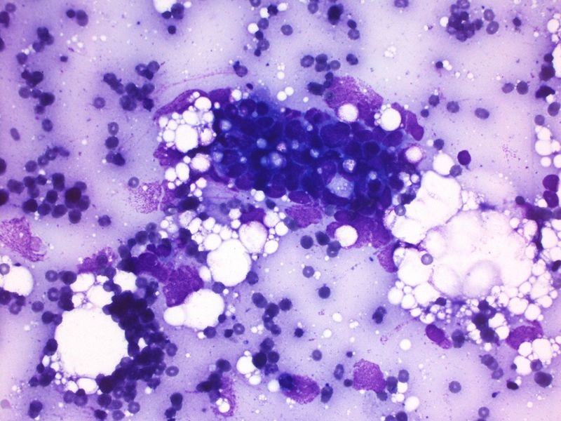 File:CytologicallyYoursUnknowns201312-4-03.jpg