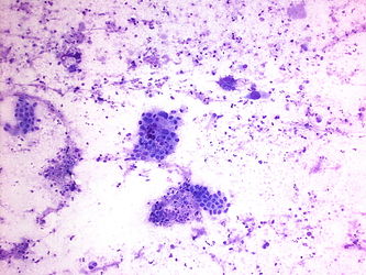 CytologicallyYoursUnknowns201401-01-03.jpg