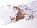 CytologicallyYoursCoW20131111Biopsy7.jpg