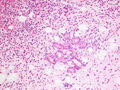 CytologicallyYoursCoW20131111Biopsy4.jpg