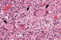 IPLab1Tuberculosis8.jpg