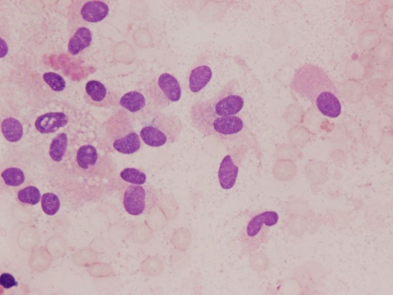 File:CytologicallyYoursUnknowns201311-4-04.jpg