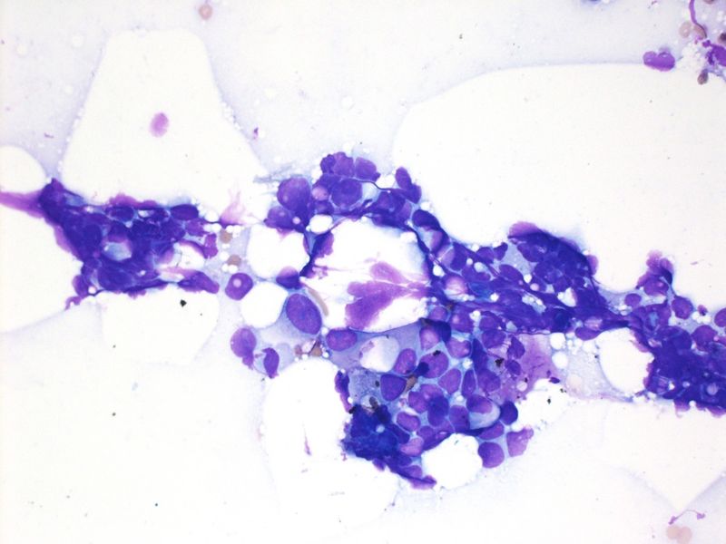 File:CytologicallyYoursUnknowns201312-5-03.jpg