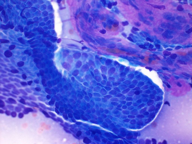 File:CytologicallyYoursUnknowns201312-2-03.jpg