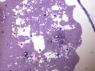 CytologicallyYoursUnknowns201310-3-07.jpg