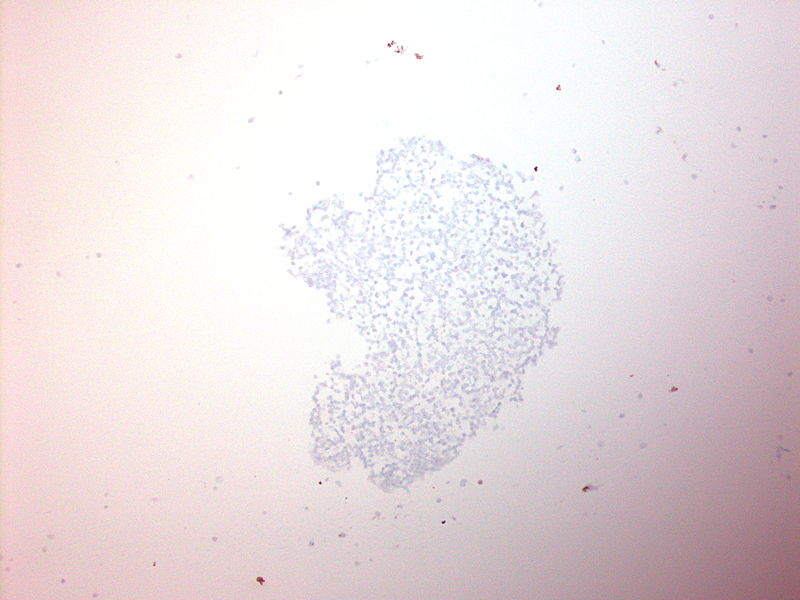 File:CytologicallyYoursUnknowns201310-3-14.jpg
