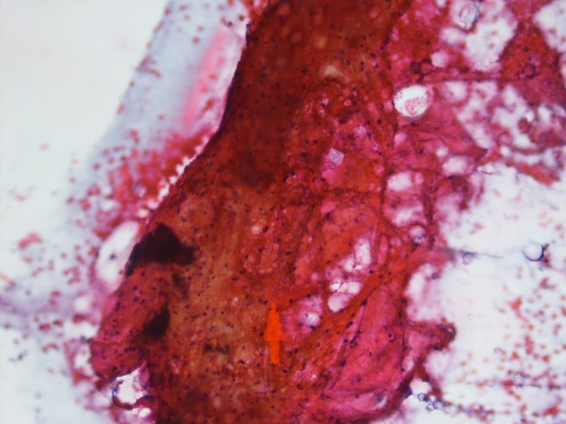 File:CytologicallyYoursUnknowns201312-3-06.jpg