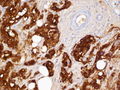 CytologicallyYoursCoW20131111Biopsy8.jpg