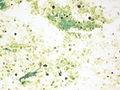 CytologicallyYoursUnknowns201310-5-08.jpg