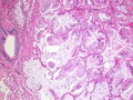 CytologicallyYoursCoW20131118Biopsy2.jpg