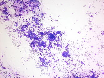 CytologicallyYoursUnknowns201310-2-04.jpg