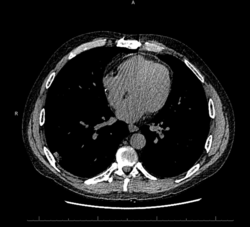 CytologicallyYoursCoW20131118Radiology1.png