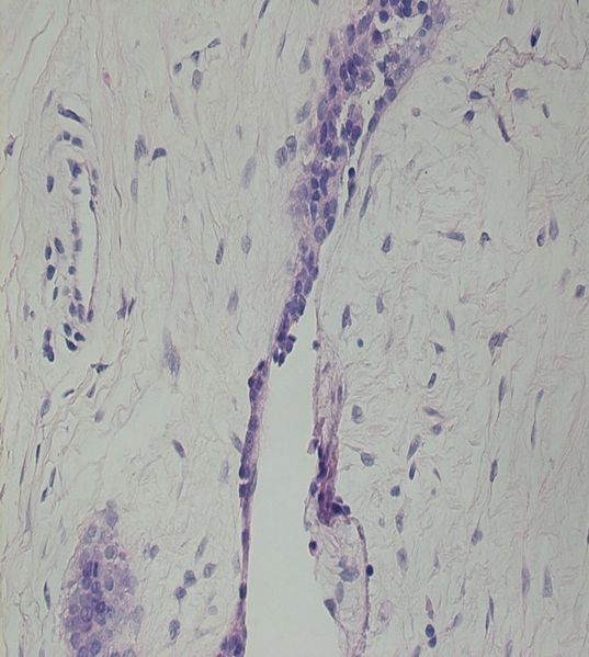 File:CytologicallyYoursUnknowns201312-3-08.jpg