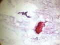 CytologicallyYoursUnknowns201312-3-05.jpg