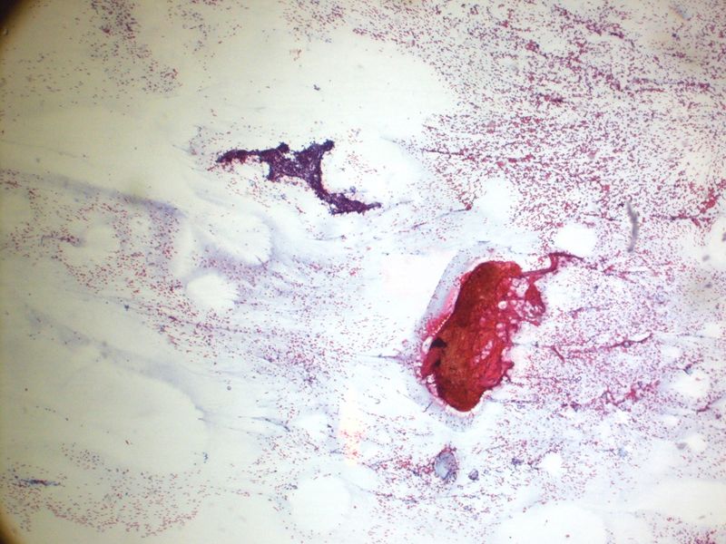 File:CytologicallyYoursUnknowns201312-3-05.jpg